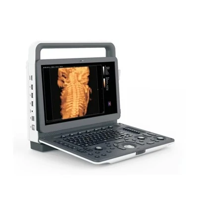 Aparat portabil cu ultrasunete color Doppler Zonecare M30 15.6 inch